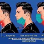 Dr Hisham Nasihat Orang Ramai Cara Memakai Topeng Pelindung Muka